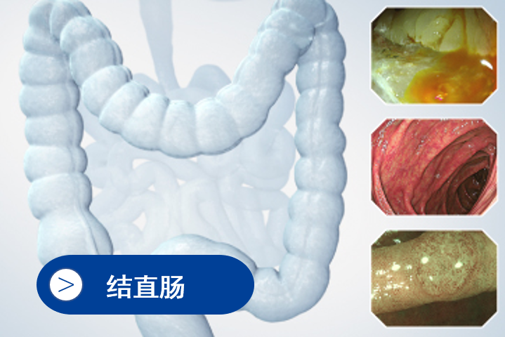 Small Intestine